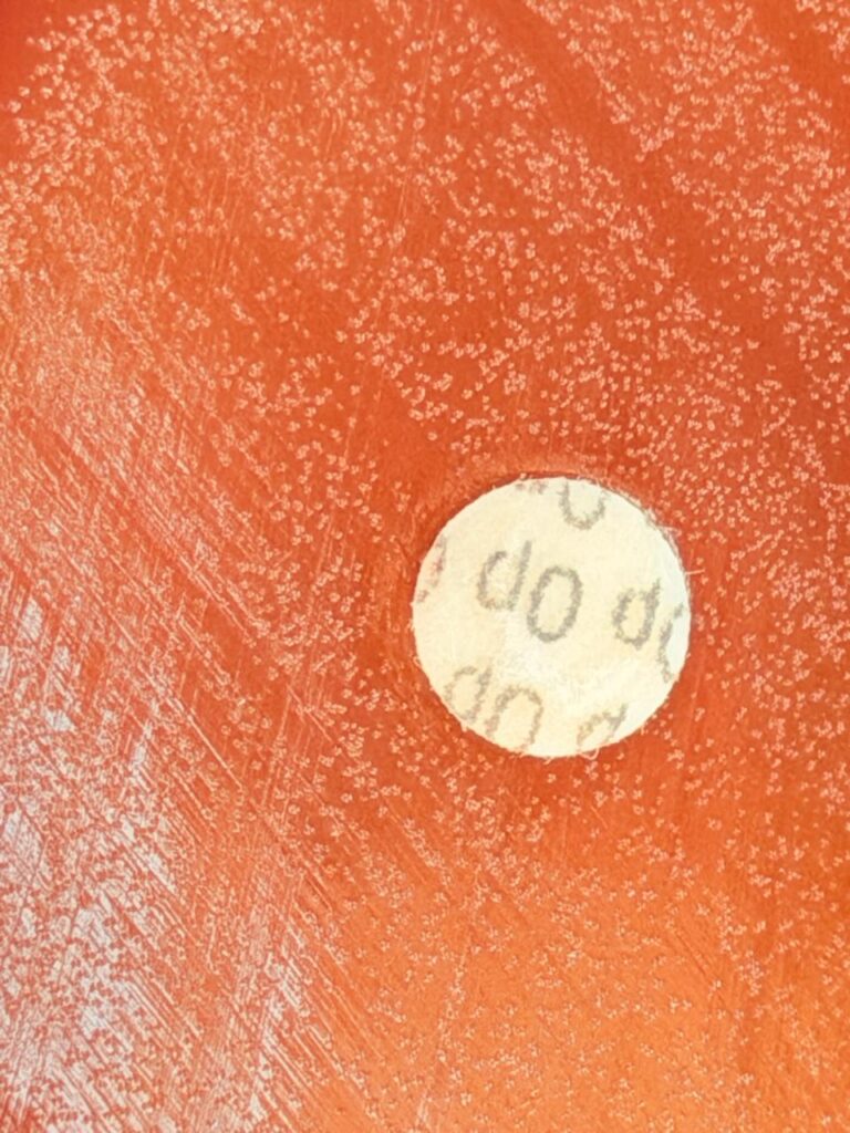 Rothia optochin resistsnt