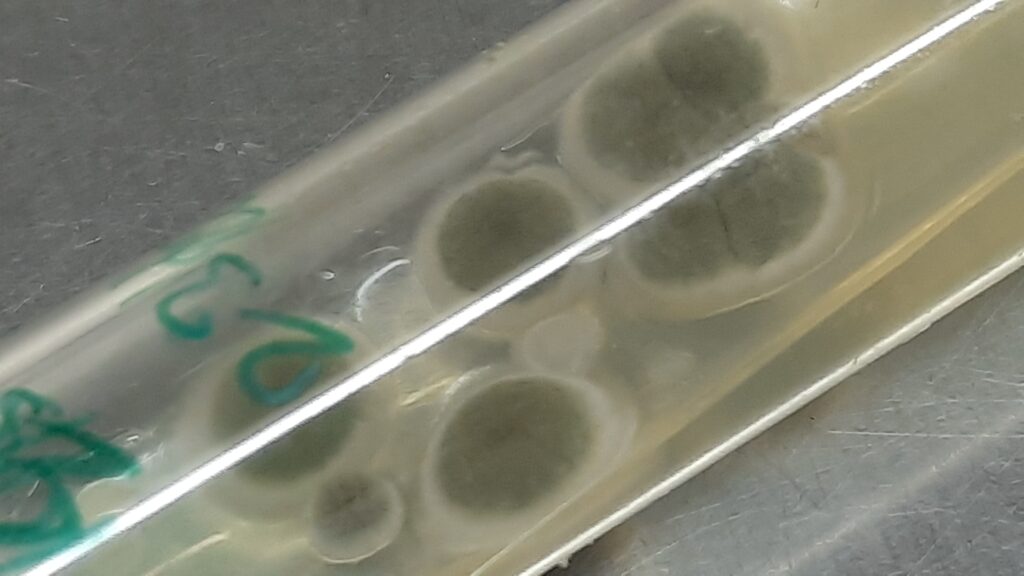 Cladophialophora growth on Sabouraud dextrose agar