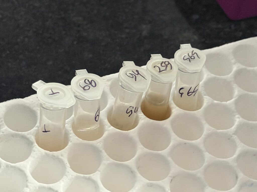 Clinical sample(BAL)