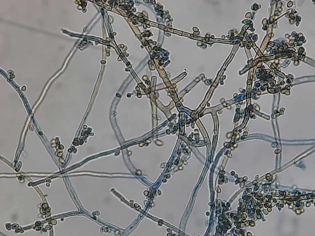 The image displays a network of pale brown, pigmented, septate hyphae producing highly branched chains of spores of Cladophialophora