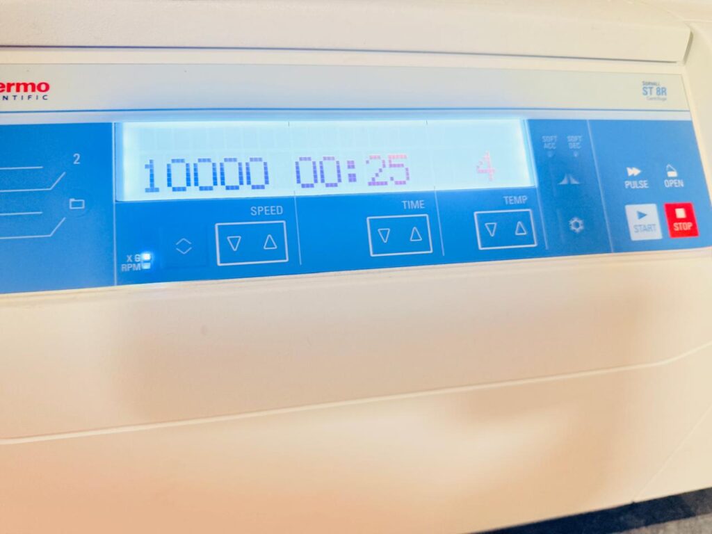 The lysis tubes during centrifugation at 10,000 × g for 1 minute