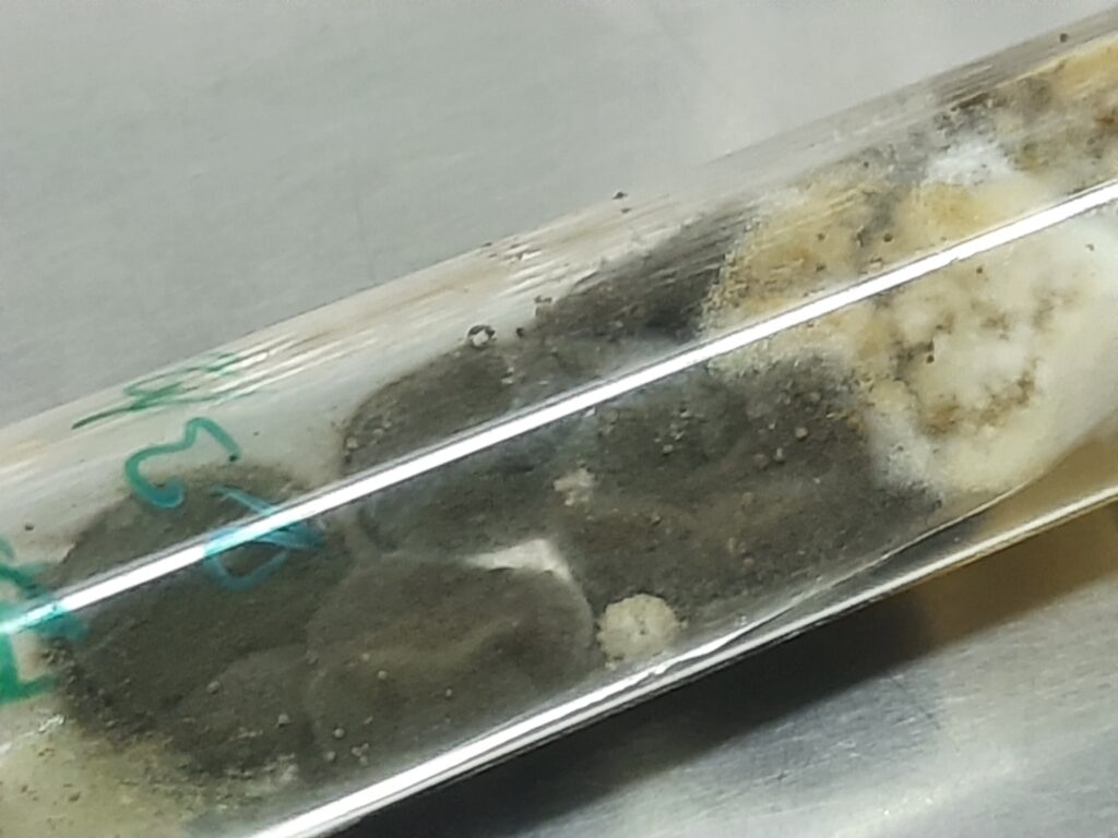 Velvety, dark olivaceous-green to grey-black colony of Cladophialophora on Sabouraud Dextrose Agar (SDA)